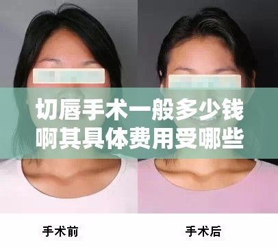 切唇手术一般多少钱啊其具体费用受哪些因素影响